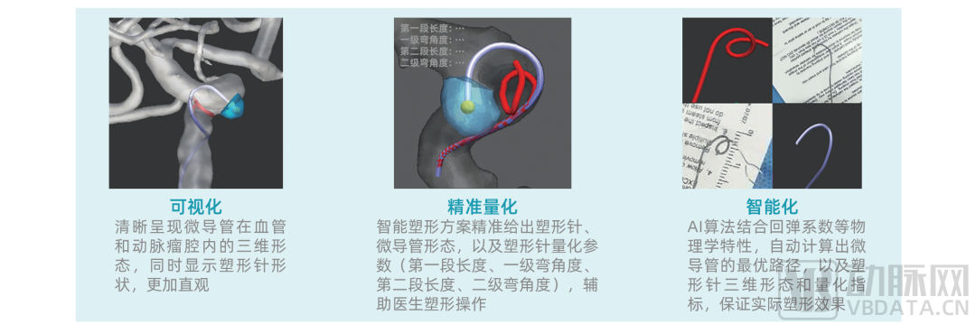 首款AI輔助治療動脈瘤軟件獲批三類證，醫療AI商業化進一步加速