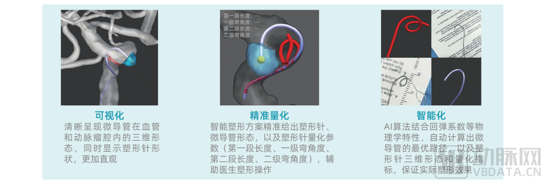 首款AI辅助治疗动脉瘤软件获批三类证，医疗AI商业化进一步加速