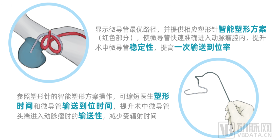 首款AI輔助治療動脈瘤軟件獲批三類證，醫療AI商業化進一步加速