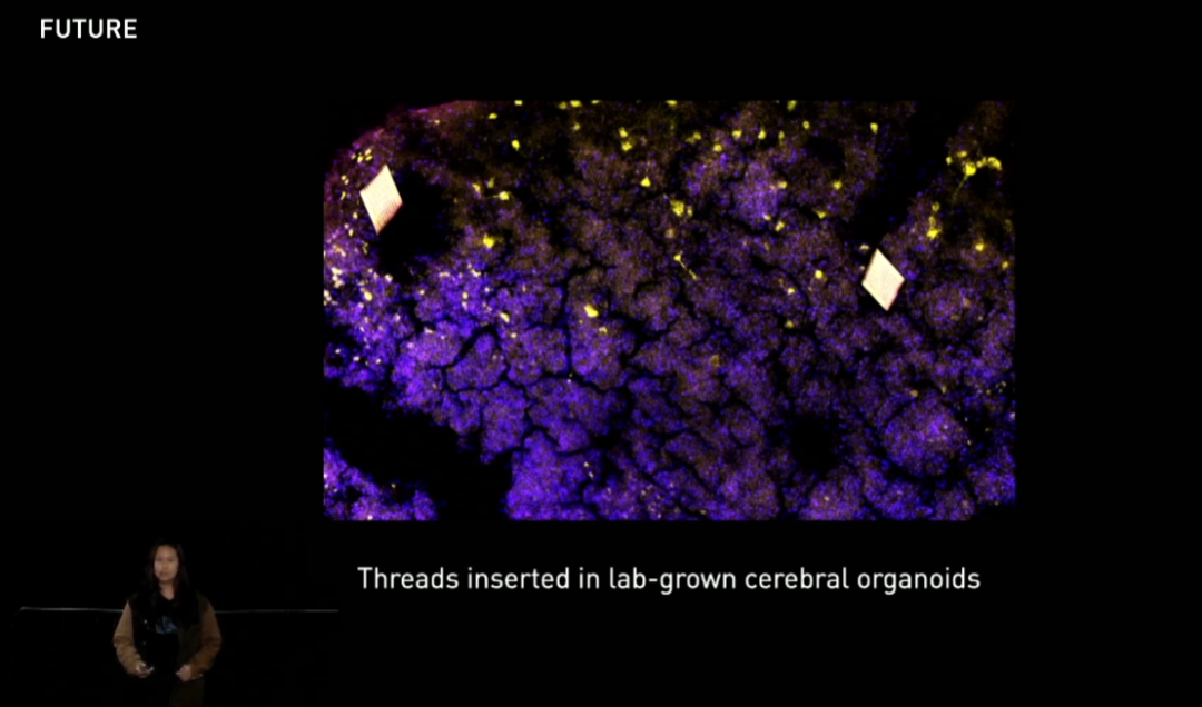 马斯克的猴子正在推动一场脑机革命，代价只是“香蕉奶昔”