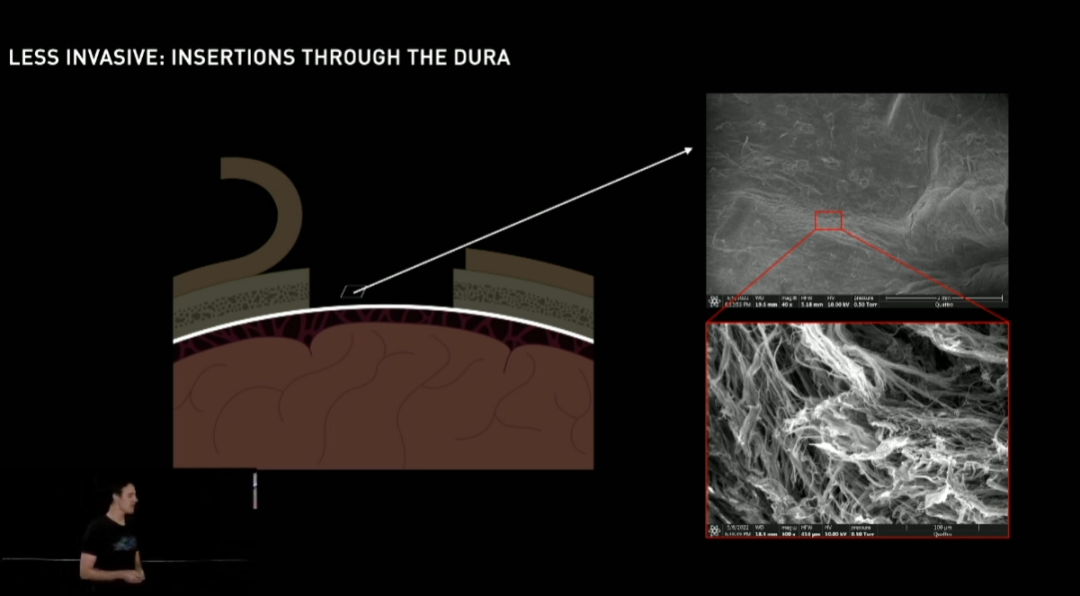 马斯克的猴子正在推动一场脑机革命，代价只是“香蕉奶昔”