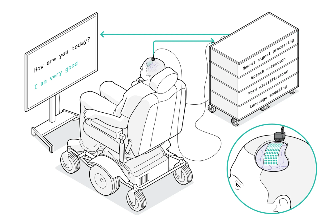 用机器学习解码一颗“失声”15年的大脑，让它“开口说话”
