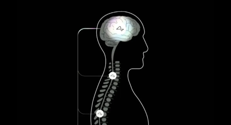 Neuralink新进展：让盲人重拾光明，让脊髓损伤者恢复运动，6个月后进行人体试验
