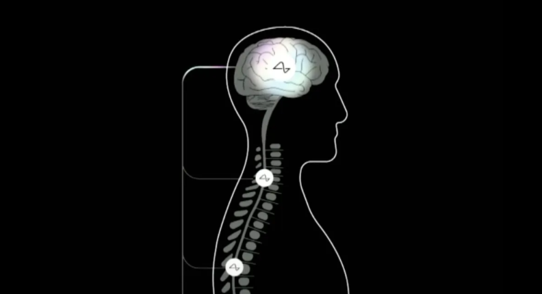 Neuralink新進展：讓盲人重拾光明，讓脊髓損傷者恢復運動，6個月后進行人體試驗